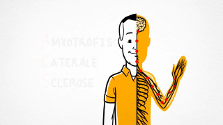 @stichtingalsnederland heeft voor onze stichting een prachtige, krachtige korte film laten maken. In slechts twee minuten zie je waar Stichting ALS op de weg voor staat. Onze missie, onze drijfveer en vooral de impact voor mensen met ALS.Wij helpen mensen met ALS om zo lang mogelijk optimaal te blijven functioneren in de maatschappij. Want meedoen, zelfstandig blijven en regie houden over je leven is van onschatbare waarde. Helaas worden noodzakelijke aanpassingen en hulpmiddelen niet altijd (volledig) vergoed door WMO of zorgverzekeraar. Juist daar springen wij bij.Kwaliteit van leven staat voorop. Voor de persoon met ALS. Voor het gezin. Voor familie en vrienden. Onze missie is helder: waar regelingen tekortschieten, maken wij het verschil. Zodat mensen in de laatste levensfase van ALS kunnen blijven doen wat voor hen belangrijk is.We zijn ongelooflijk trots op wat we samen mogelijk maken en dankbaar voor iedereen die dit steunt en deelt. ❤️#StichtingALS #StopALS #kwaliteitvanleven #ALSopdeweg