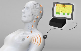 ALSopdeweg! - UMC Neuroprothese